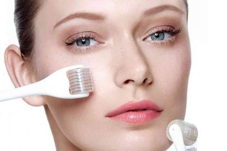 Problèmes pour faire adopter le micro needling