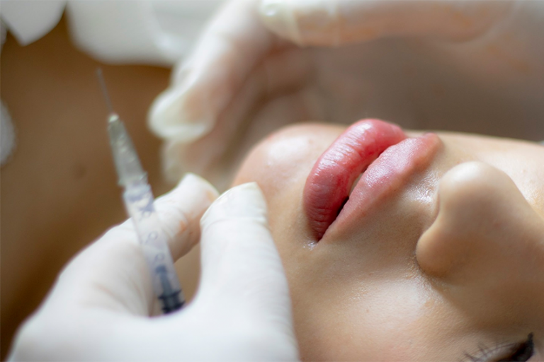 Une esthéticienne condamnée pour injections illégales à Toulouse