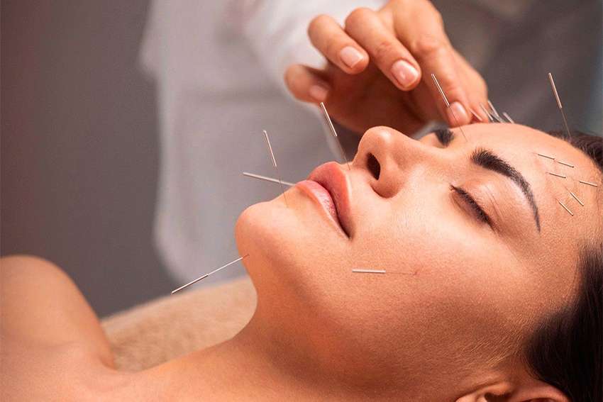 Comment se déroule une séance d'acupuncture