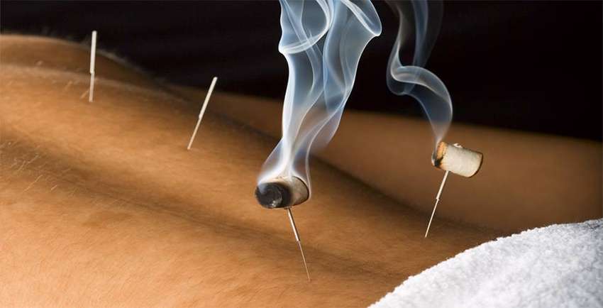 Moxibustion
