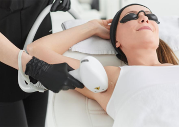 EPILATION LASER