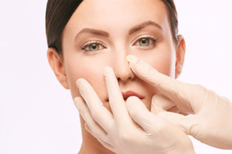 Rhinoplastie