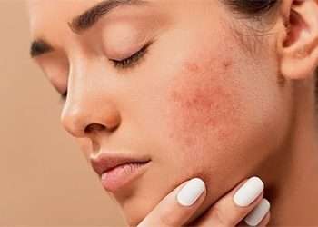 Etats inflammatoires