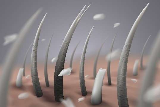 PELLICULES SÈCHES