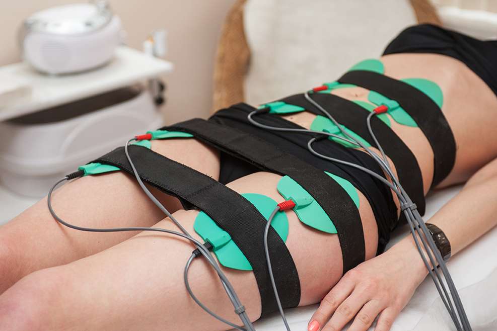 Electrostimulation