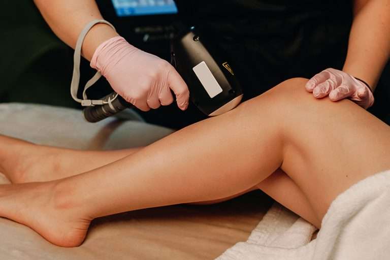 épilation laser et IPL