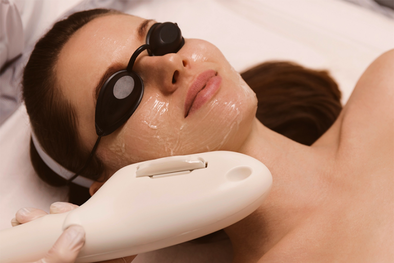 lumière pulsée IPL