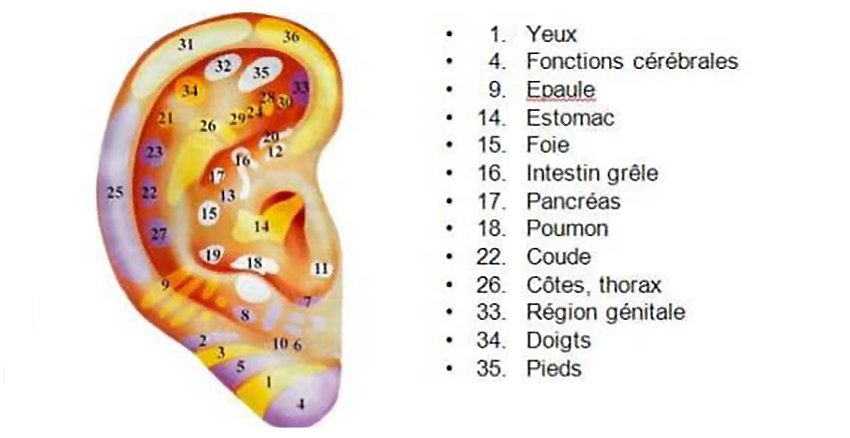 Auriculotherapie